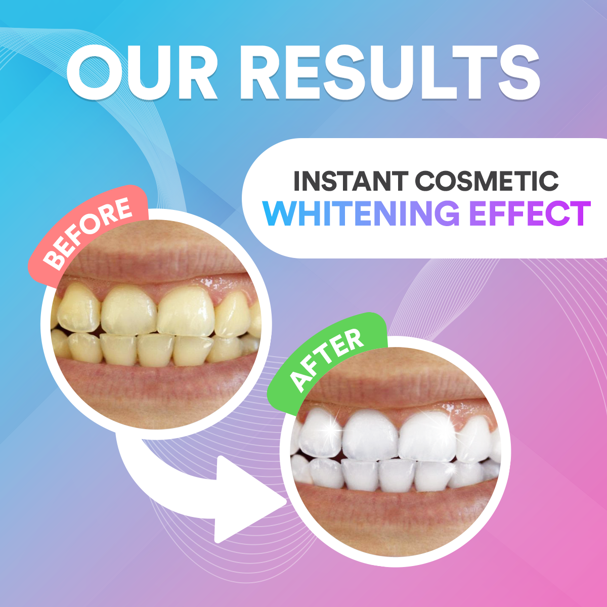 Instant Teeth Whitening Pen