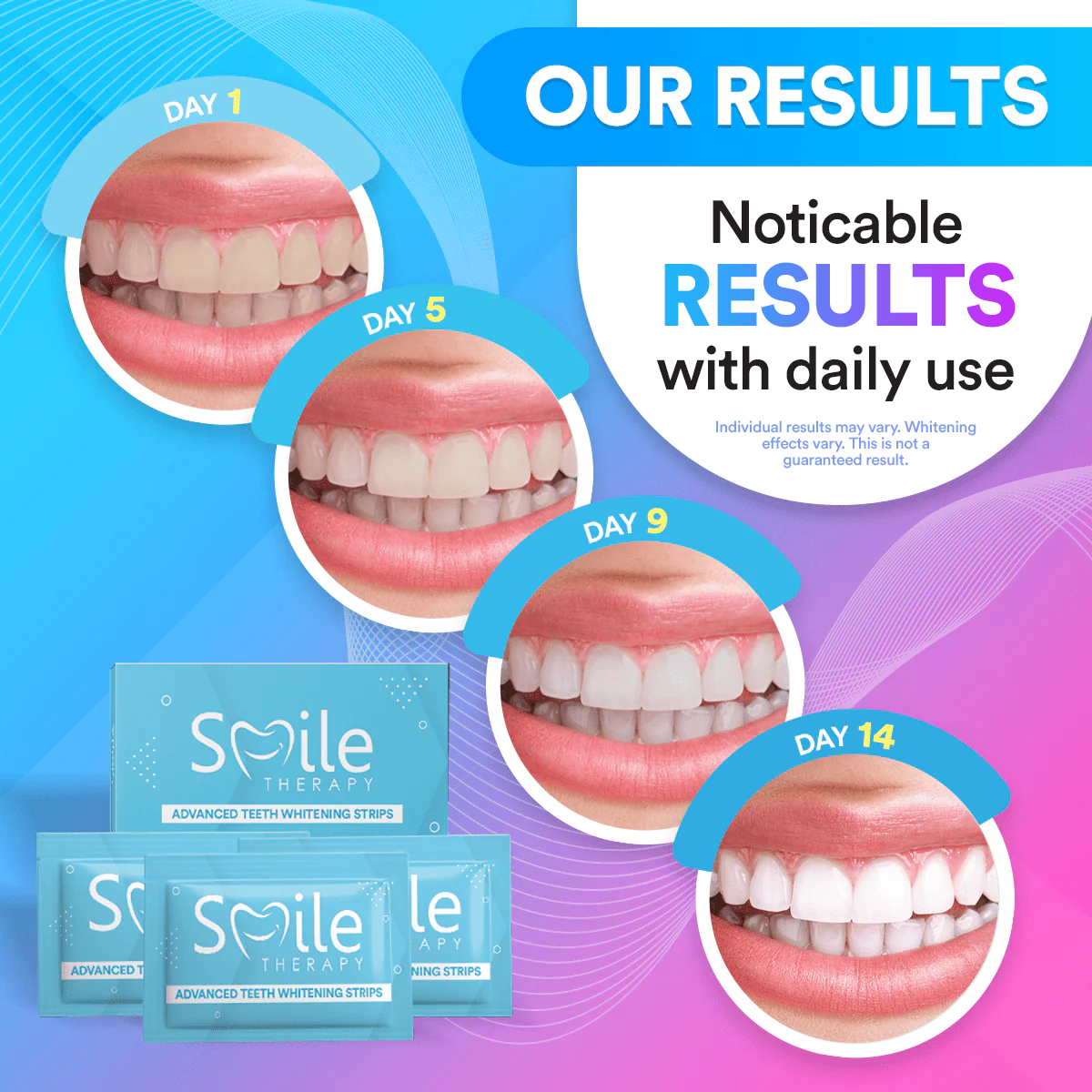 Teeth Whitening Strips (14 Treatments) DP5