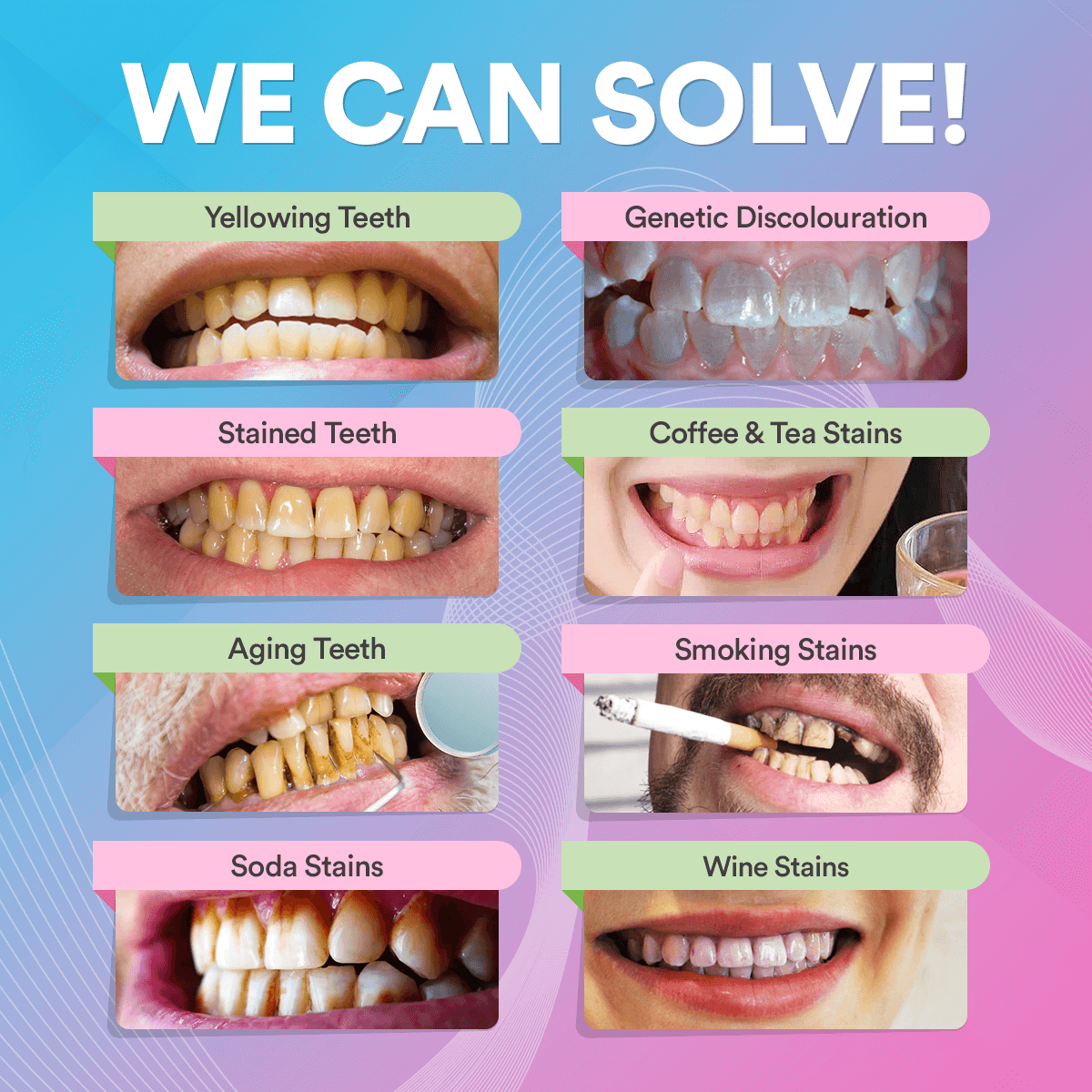 Instant Teeth Whitening Pen