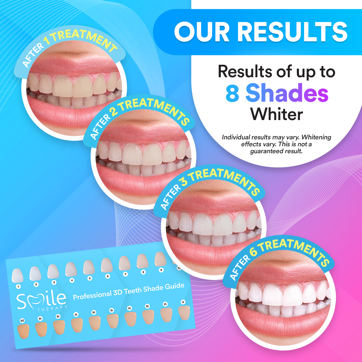 Advanced Teeth Whitening Kit PAP+