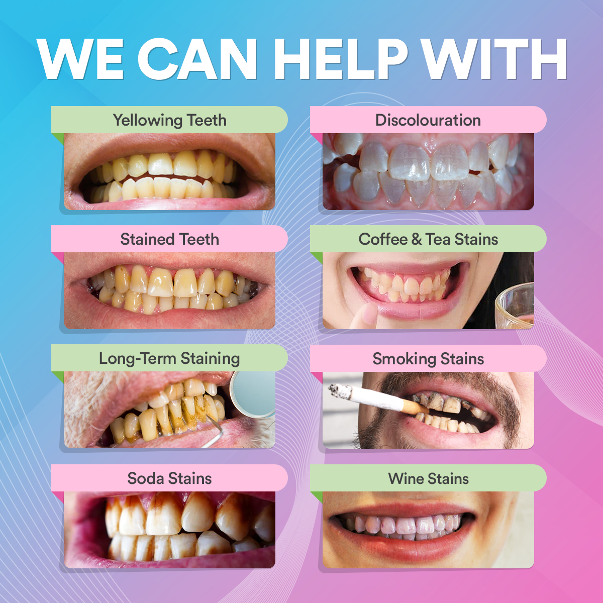 Teeth Whitening Pen DP7